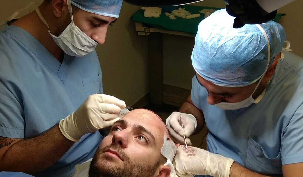 هل زراعة الشعر تسبب السرطان