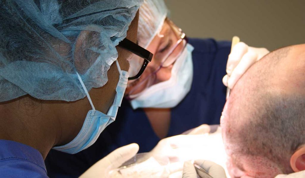 زراعة الشعر بالاقتطاف