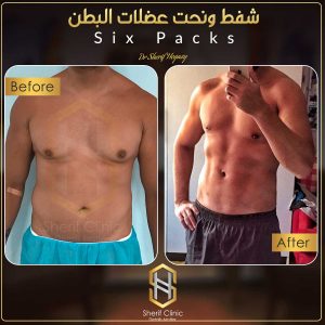 النحت الديناميكي