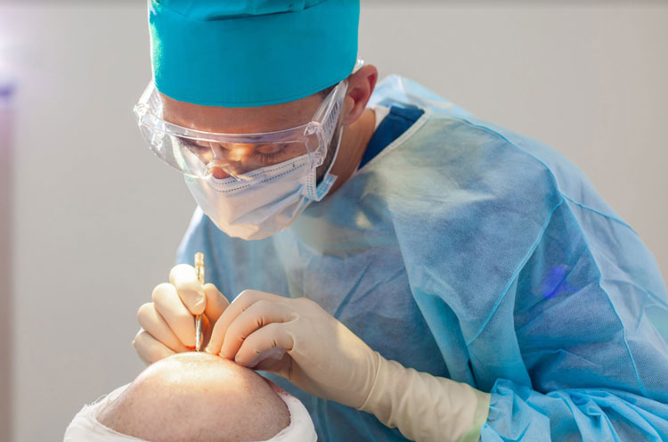 اضرار زراعة الشعر