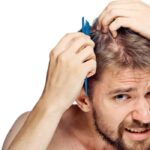 زراعة الشعر الطبيعي