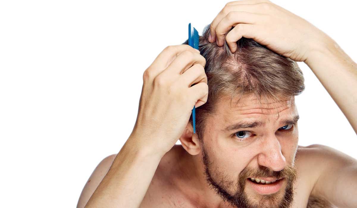 زراعة الشعر الطبيعي