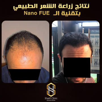 جلسات البلازما