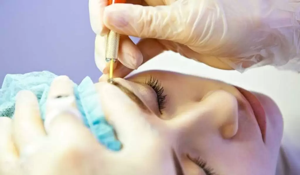 زراعة شعر الحواجب