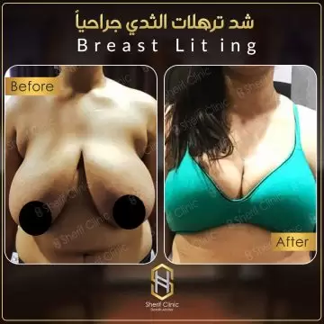 نحت جسم المرأة