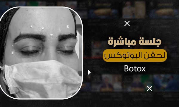 استخدامات البوتوكس