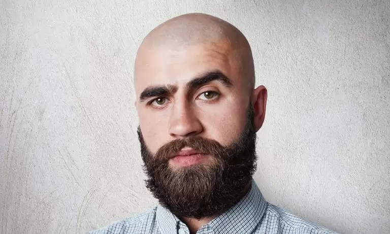 تكاليف زراعة الشعر في مصر