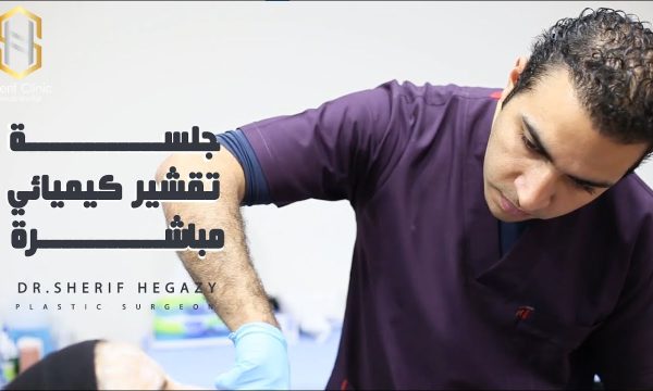 خطوات جلسة تقشير البشرة الكيميائي