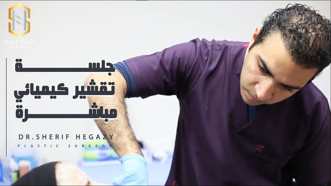 خطوات جلسة تقشير البشرة الكيميائي