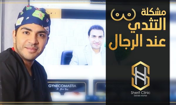 أنواع تثدي الرجال