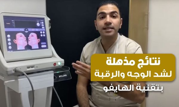 الهايفو لشد ترهلات الوجه