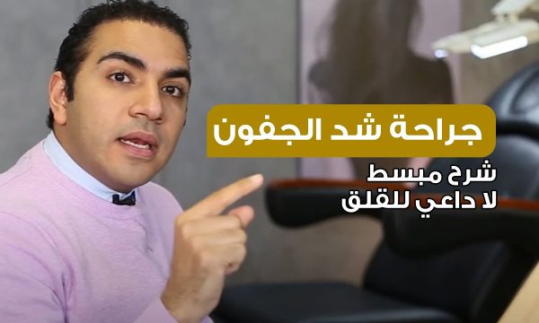 جراحة شد الجفون