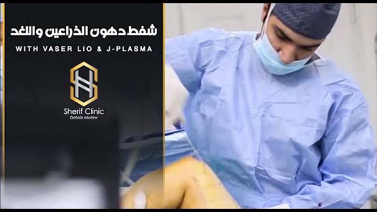 شفط دهون الذراعين واللغد