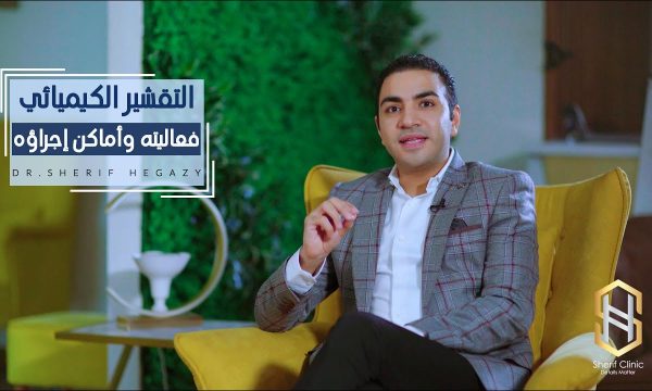 فعالية التقشير الكيميائي
