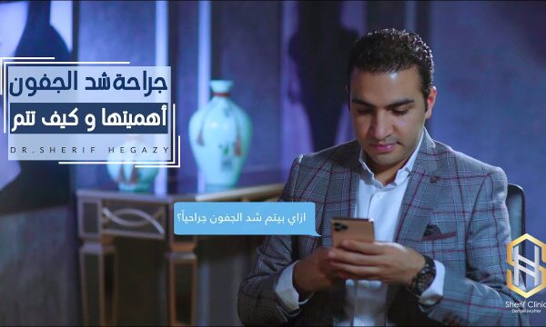 كيف يتم شد الجفون