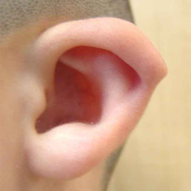 تكلفة عملية تجميل الاذن في مصر