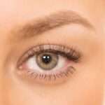 عملية شد الجفون