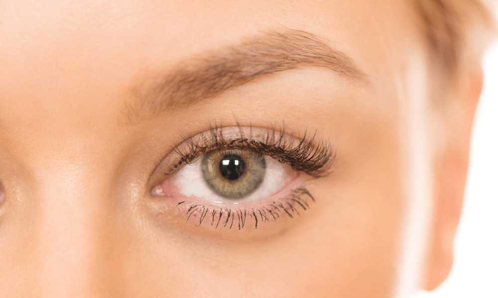 عملية شد الجفون