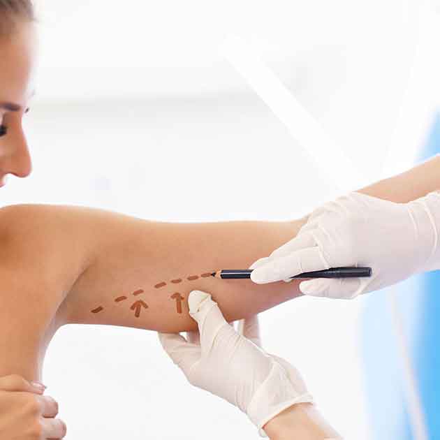 أسباب ترهل الذراعين عند النساء