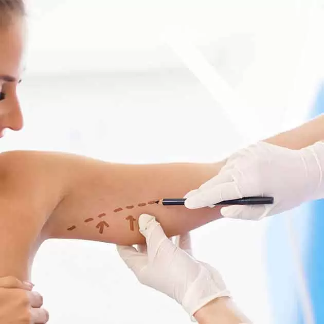 الاستعداد لعملية شفط دهون الذراعين