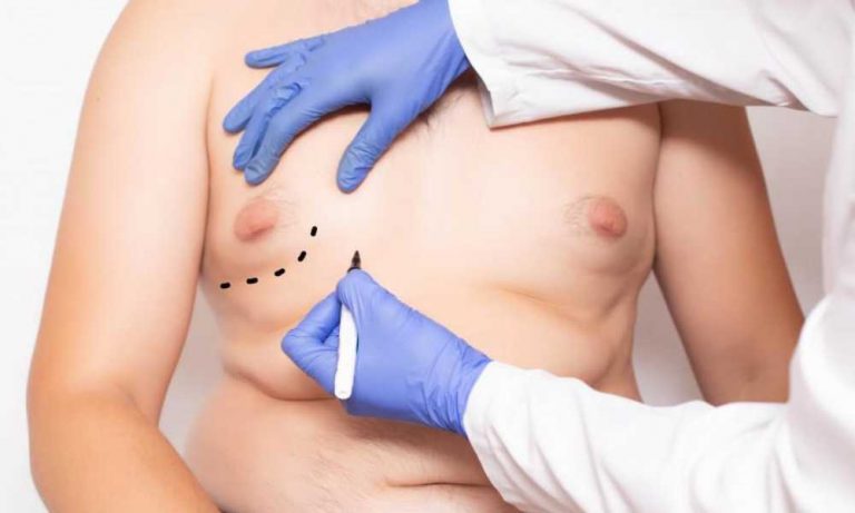 تثدي الرجل الكاذب