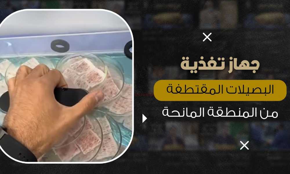 تغذية بصيلات الشعر