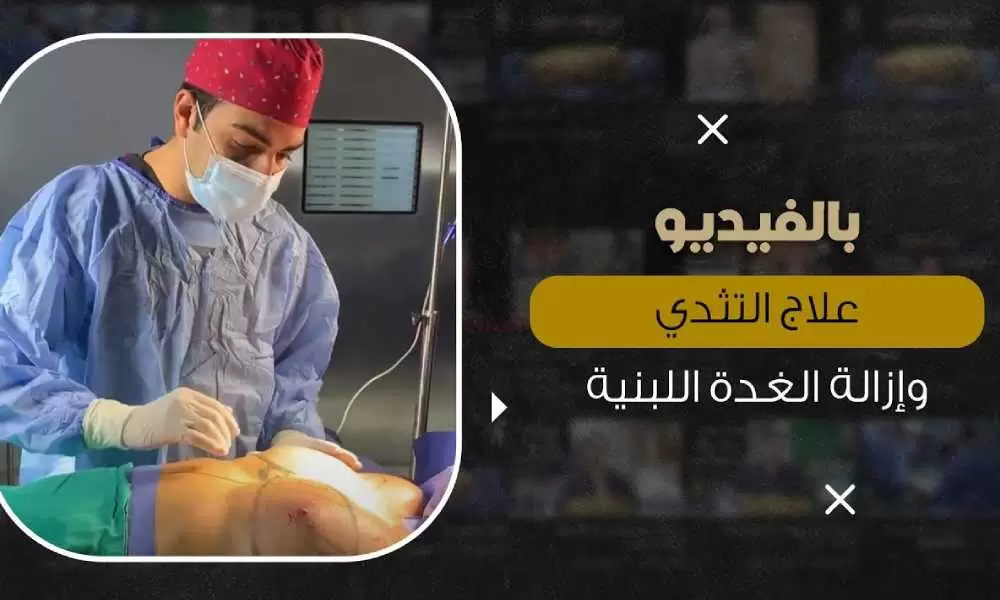 علاج تثدي الرجل