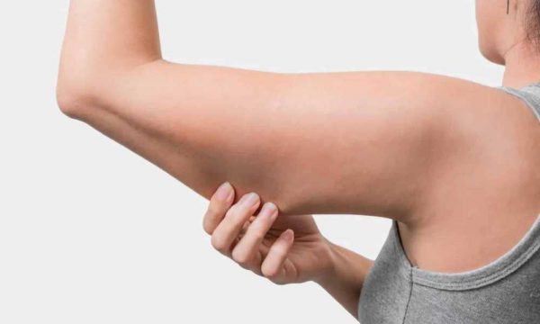 اضرار شفط الدهون من الذراعين