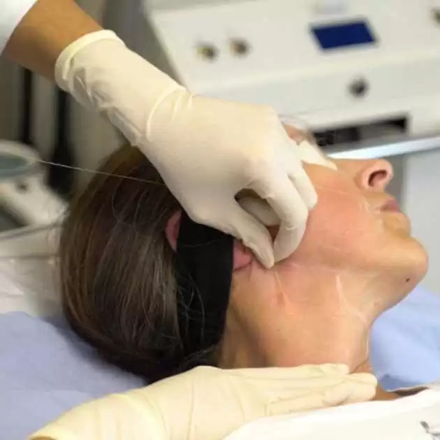 endolift