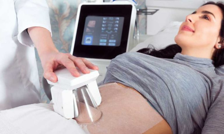 التنحيف بالتجميد