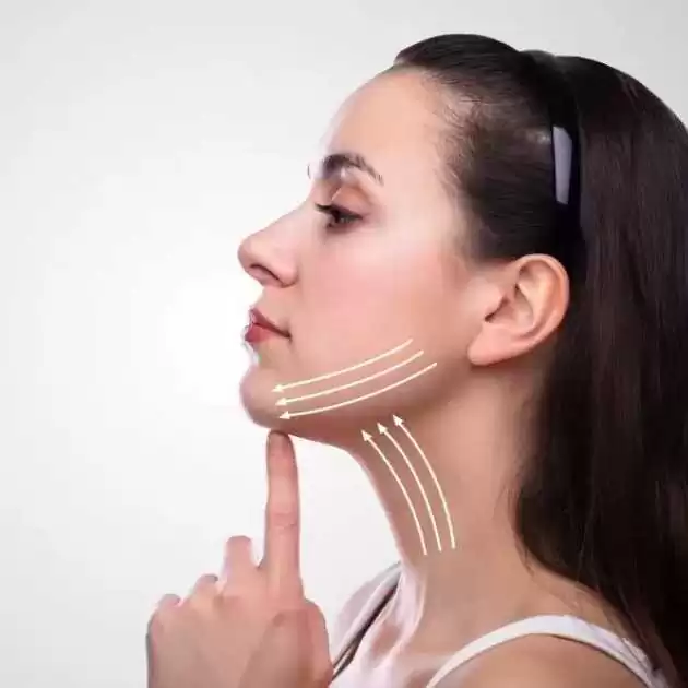 شفط دهون الوجه قبل وبعد
