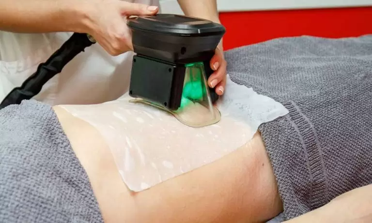 اسعار جلسات الكرايو