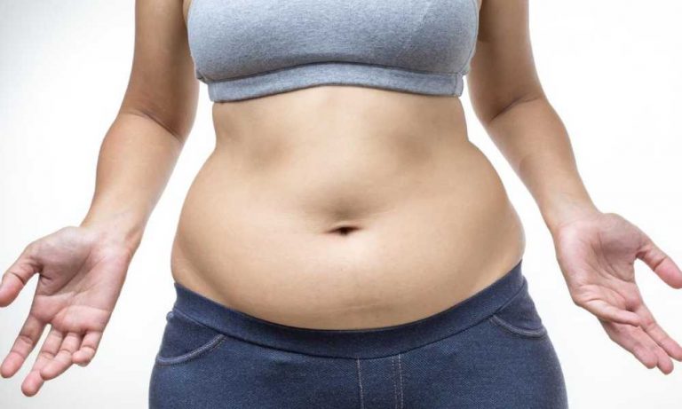 تجمع السوائل بعد عملية شد البطن