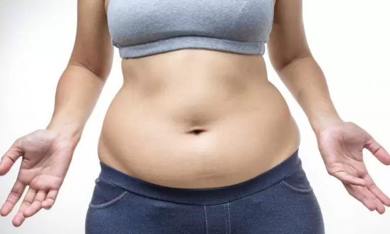 تجمع السوائل بعد عملية شد البطن