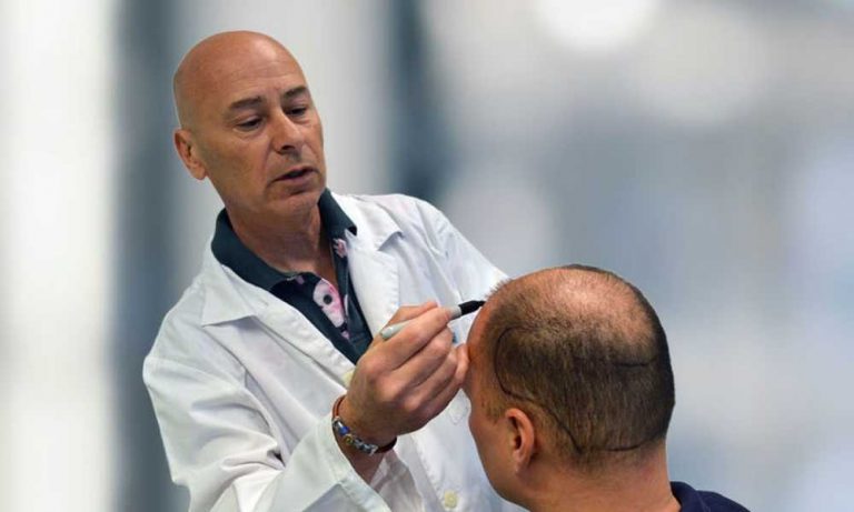 زراعة الشعر بتقنية الأقلام الذكية