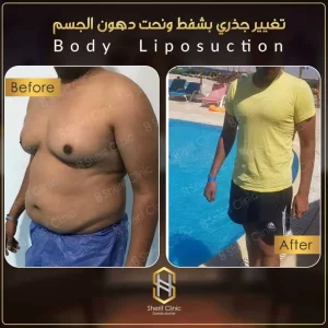 اجهزة تفتيت الدهون واسعارها
