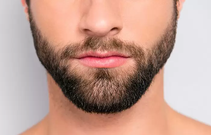 زراعة شعر الذقن
