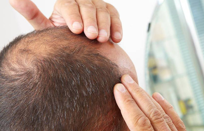 مركز زراعة الشعر