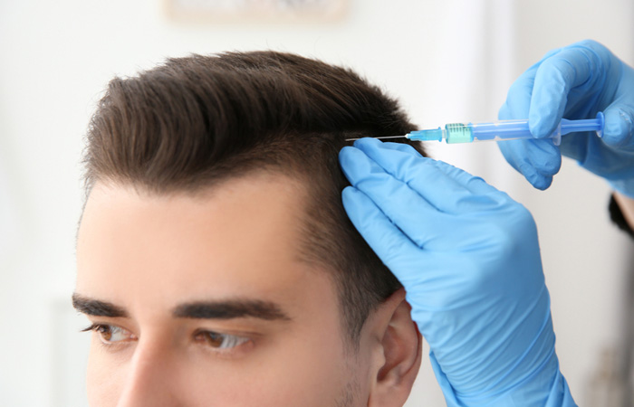 هل زراعة الشعر ناجحة