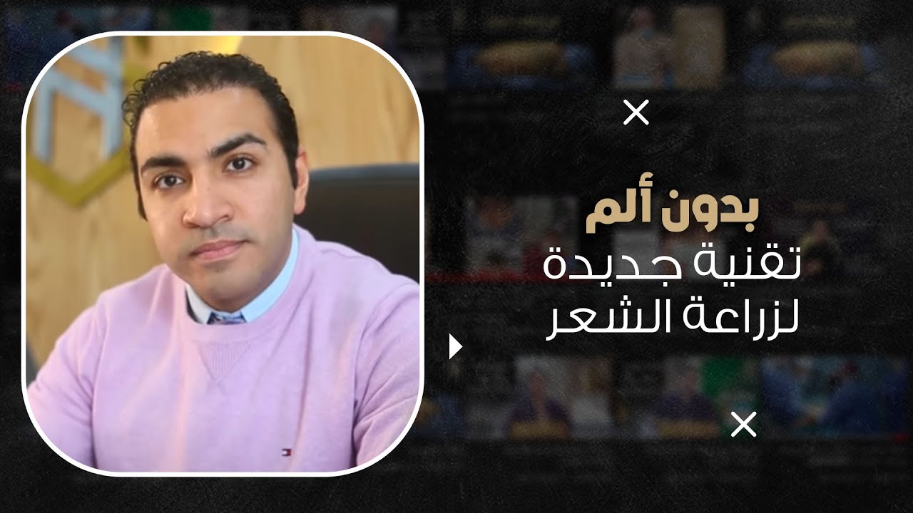 كيفية زراعة الشعر بدون ألم