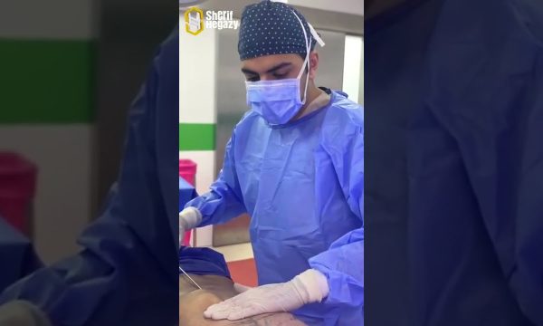 نحت الجسم الديناميكي للرجال وإزالة التثدي بشكل نهائي