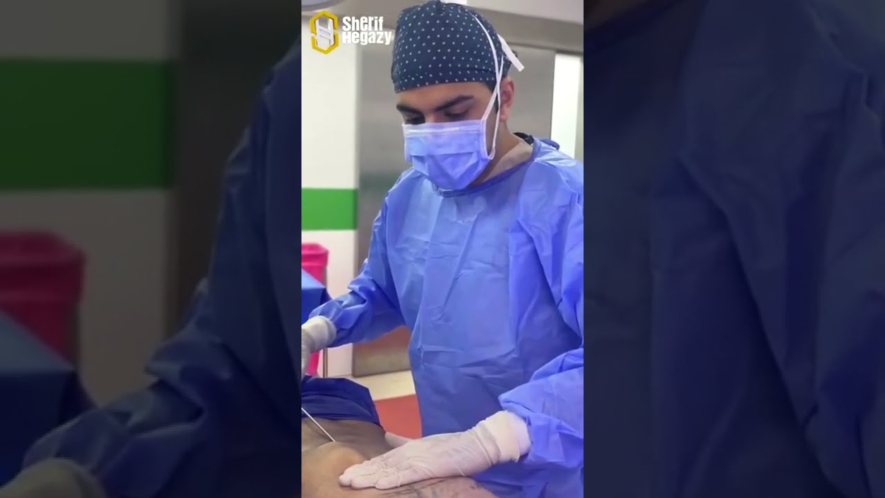 نحت الجسم الديناميكي للرجال وإزالة التثدي بشكل نهائي