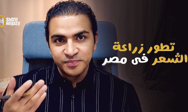 زراعة الشعر في مصر