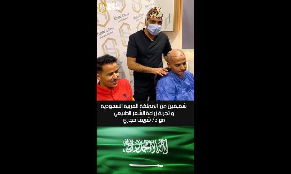 شاهد نتيجة رائعة لزراعة الشعر الطبيعي لأخواتنا من السعودية