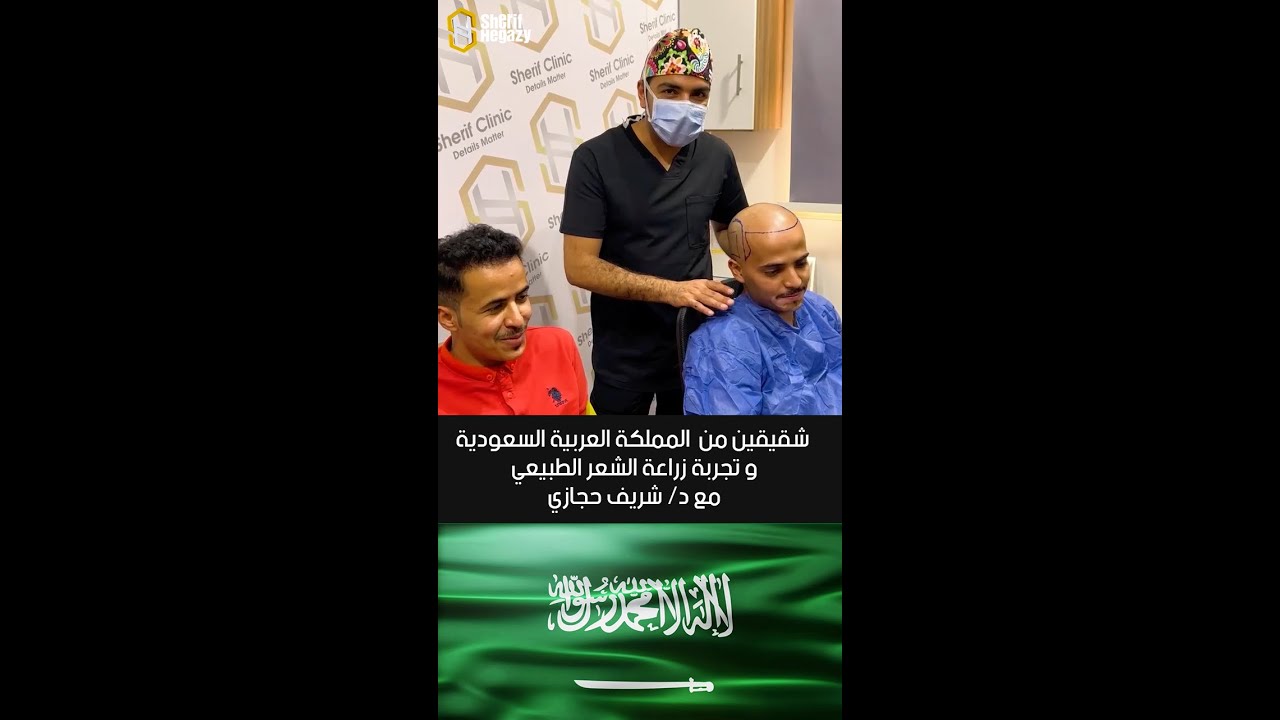 شاهد نتيجة رائعة لزراعة الشعر الطبيعي لأخواتنا من السعودية