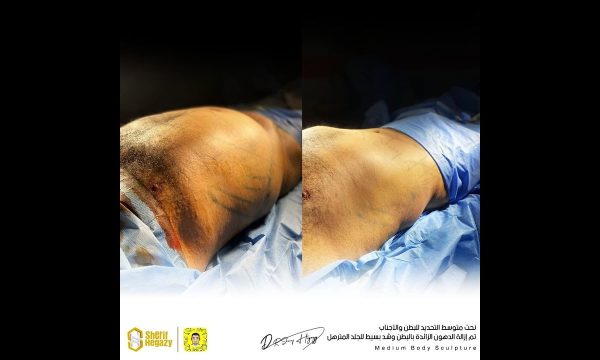 أيه الفرق بين نحت الجسم عالي التحديد ومتوسط التحديد ؟