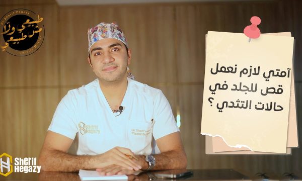 امتى لازم نعمل قص للجلد في حالات التثدي عند الرجال؟
