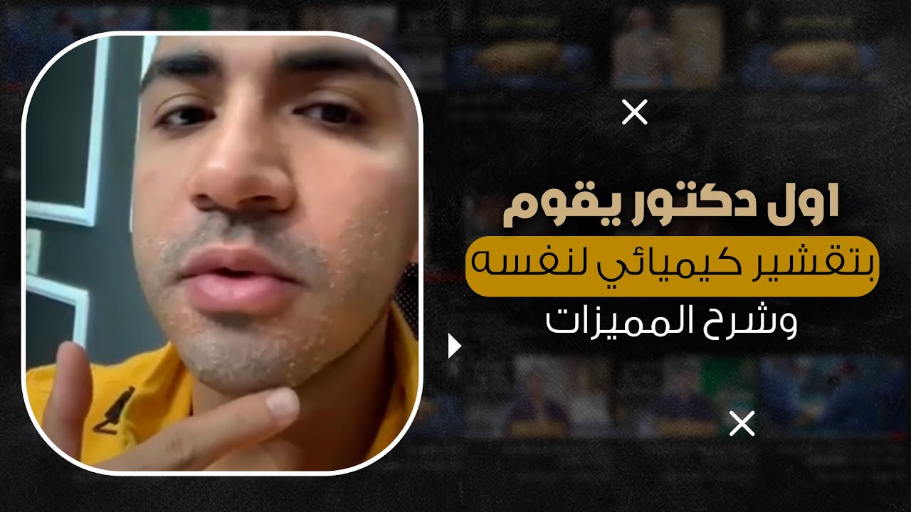 اول دكتور يقوم بتقشير كيميائي لنفسه وشرح المميزات