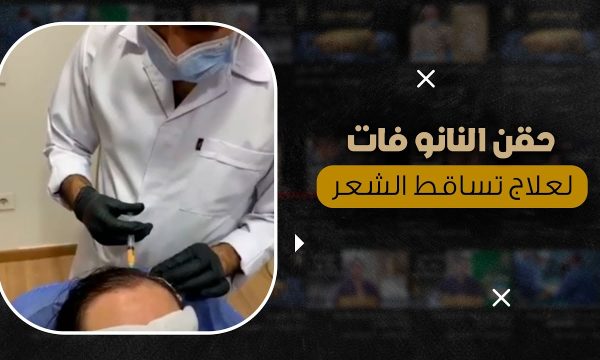 حقن النانو فات لعلاج تساقط الشعر