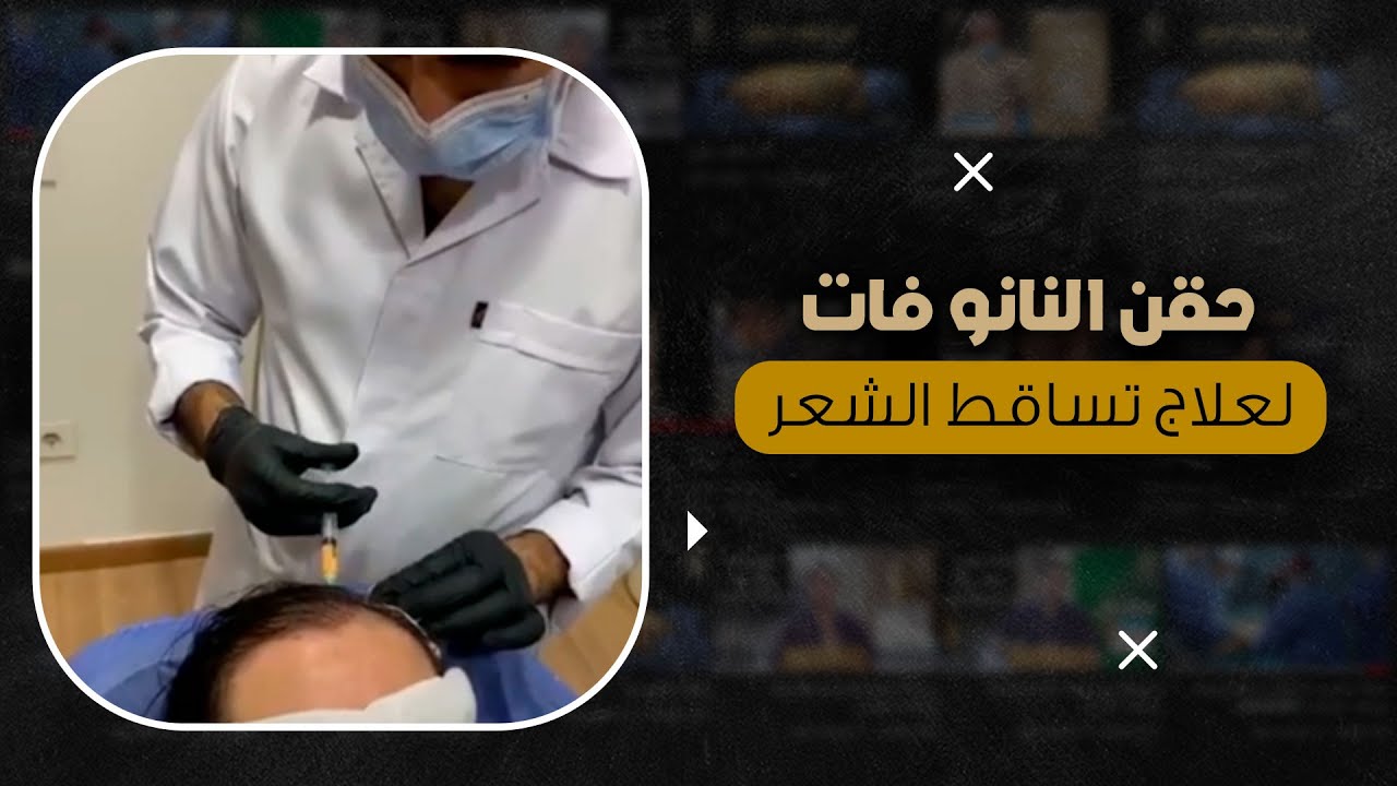 حقن النانو فات لعلاج تساقط الشعر